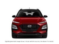 2018 Hyundai Kona 2.0L Luxury AWD Exterior Shot 5